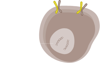  正常细胞